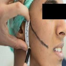 mina hair clinic saç ekim merkezi